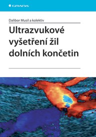 E-kniha Ultrazvukové vyšetření žil dolních končetin