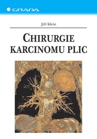 E-kniha Chirurgie karcinomu plic