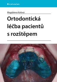 E-kniha Ortodontická léčba pacientů s rozštěpem
