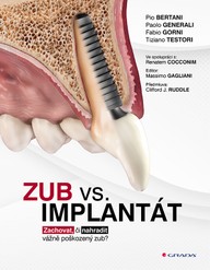 E-kniha Zub vs. implantát