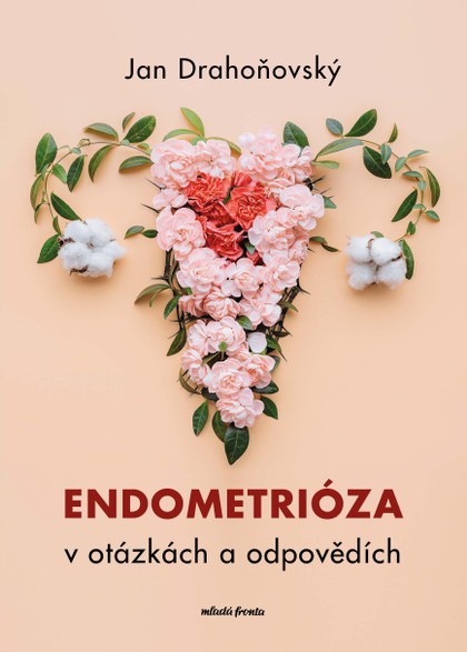 E-kniha Endometrióza v otázkách a odpovědích