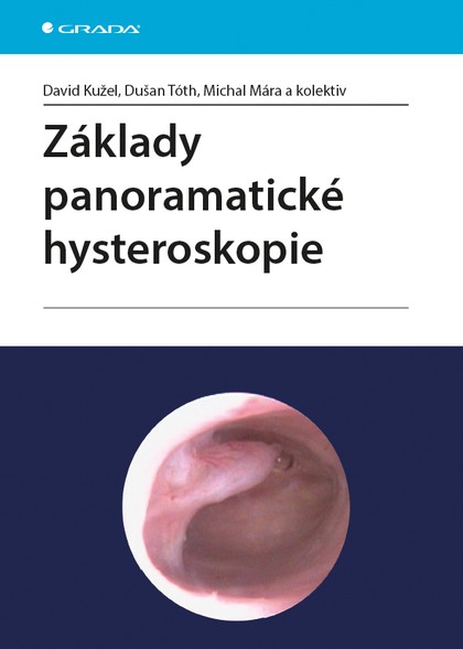 E-kniha Základy panoramatické hysteroskopie