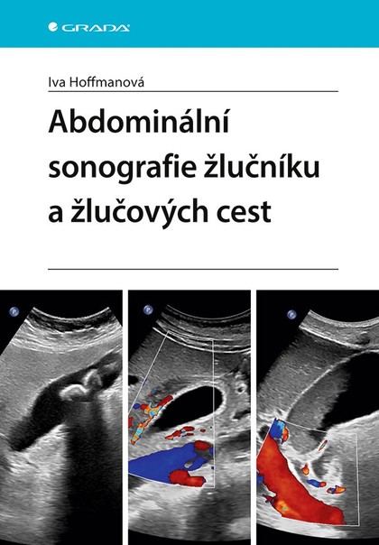 E-kniha Abdominální sonografie žlučníku a žlučových cest