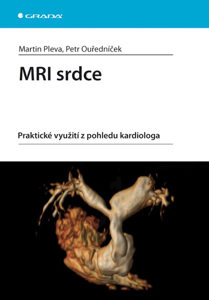 E-kniha MRI srdce