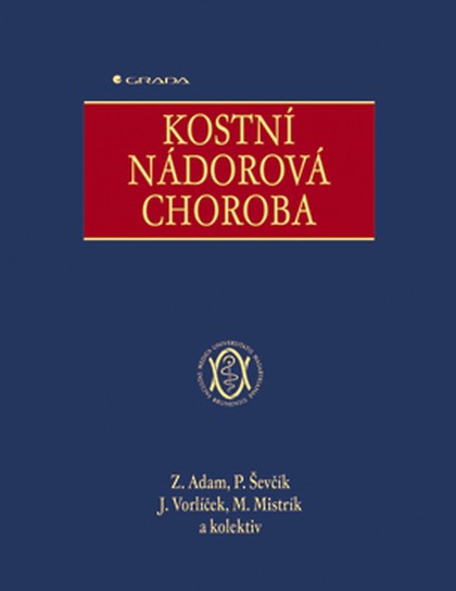 E-kniha Kostní nádorová choroba