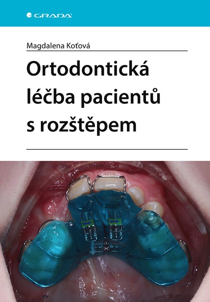 E-kniha Ortodontická léčba pacientů s rozštěpem