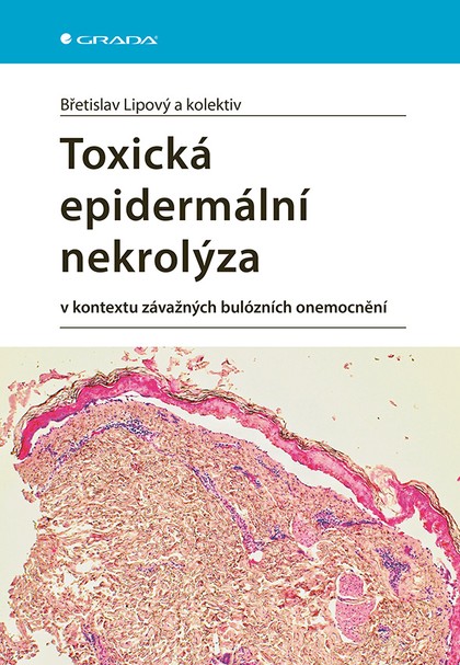 E-kniha Toxická epidermální nekrolýza