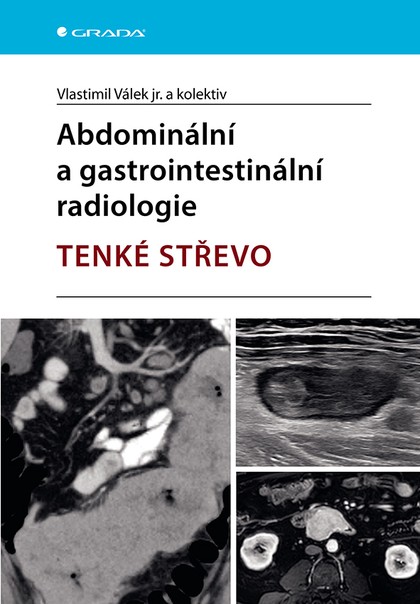 E-kniha Abdominální a gastrointestinální radiologie - TENKÉ STŘEVO